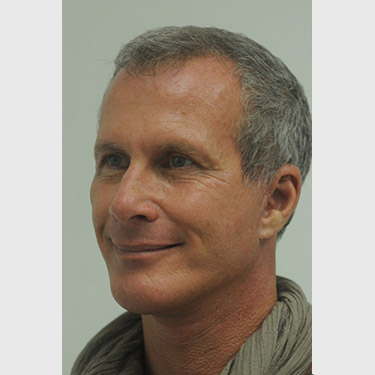 male-facelift-patient-07 After